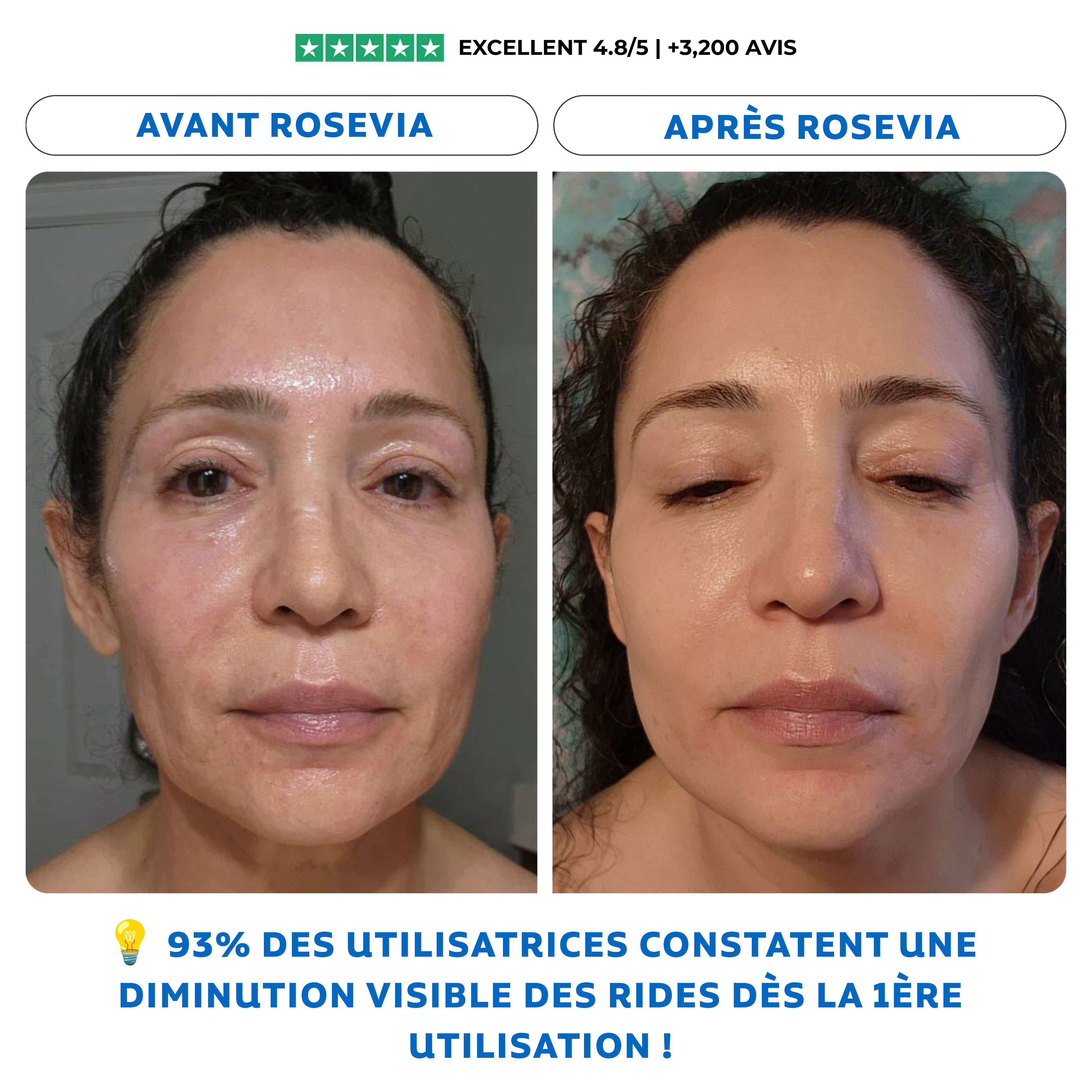 Patchs Anti-Rides Roservia by ceralyne